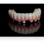 All-Zirconia-Screw-Retained-Bridges-scaled-e1584703590333-pj7v9ueyrwuws1hd7o79hv47s0zs41po5hj3nysyc0